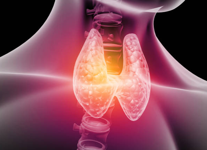 Thyroid Disorders